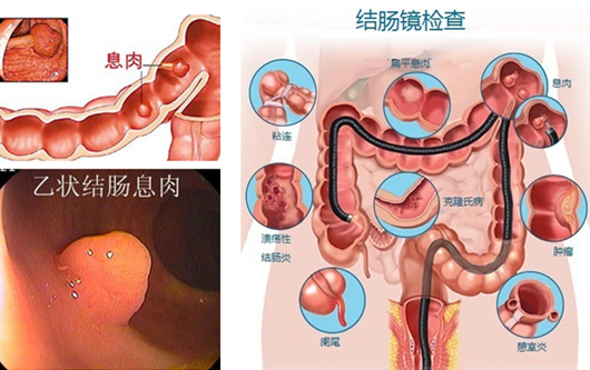 萎縮性胃炎真的“很嚇人”？看完這“七個(gè)事實(shí)”你就明白了