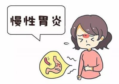 治療慢性胃炎的方法是什么